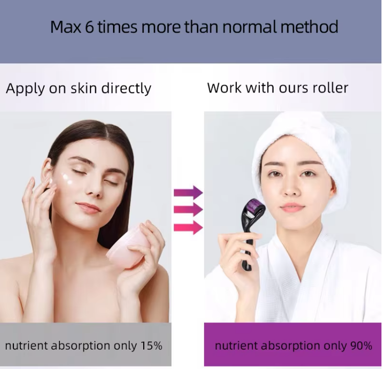 Hot Sell 540 micro needle derma roller for skin beauty care